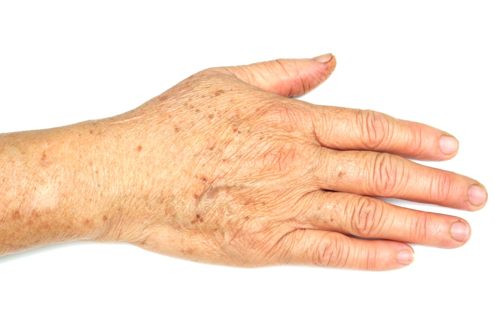 knowing the signs of carpal tunnel syndrome 5fbe9596103aa